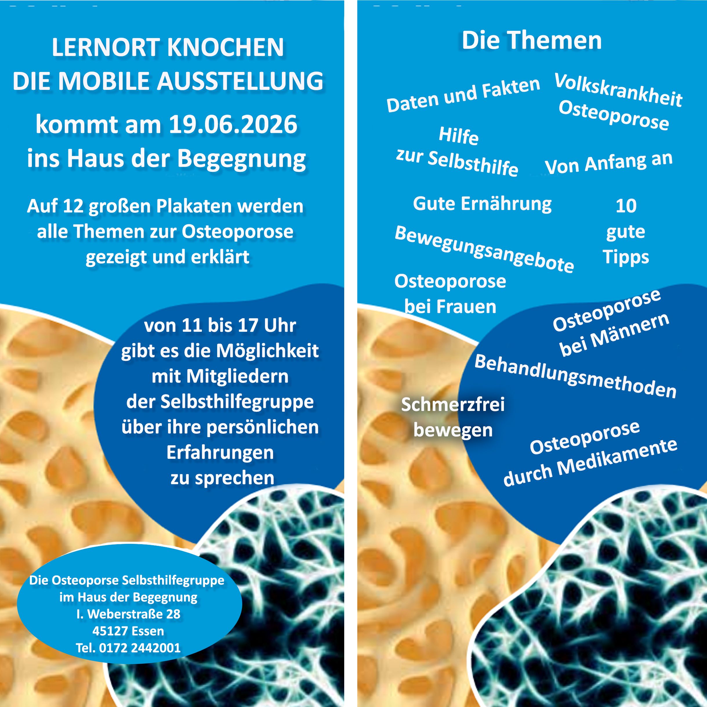 Mobile Ausstellung „Lernort Knochen“ kommt nach Essen