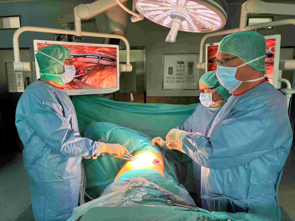 Das Bild zeigt eine Operation in einem modernen Operationssaal. Drei medizinische Fachkräfte stehen um eine auf dem Rücken liegende Patientin oder einen Patienten, der vollständig mit grünen OP-Tüchern abgedeckt ist. Nur ein kleiner Bereich im seitlichen Brustkorb ist freigelegt und wird von einer hellen Operationslampe ausgeleuchtet. Dort arbeiten zwei der Operierenden mit chirurgischen Instrumenten durch eine runde Öffnung. Alle drei Personen tragen grüne OP-Kleidung, Hauben, Mund-Nasen-Schutz und sterile Handschuhe. Zwei stehen rechts und links am Operationstisch und führen Instrumente, eine weitere Person steht im Hintergrund und beobachtet einen Monitor. Auf zwei großen Bildschirmen ist eine vergrößerte Ansicht des Operationsgebiets im Inneren des Körpers zu sehen, mit deutlich erkennbaren Gewebestrukturen und chirurgischen Instrumenten. Über dem Team hängt eine große runde OP-Leuchte. Die Atmosphäre wirkt konzentriert und professionell.