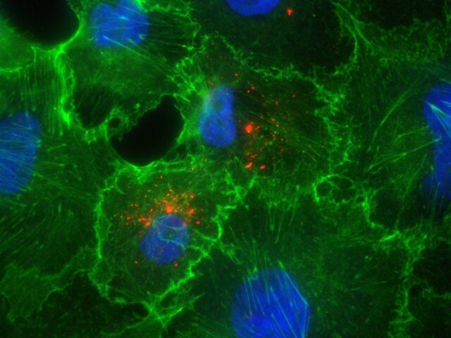 Forschende der Medizinischen Fakultät ordnen aktuelle Hantavirus-Fälle ein