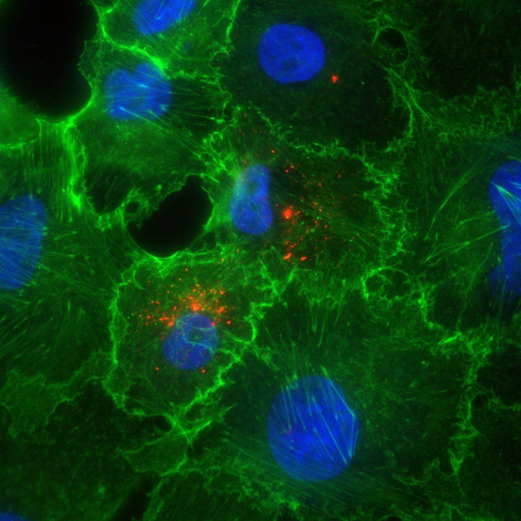 Fluoreszenzmikroskopische Aufnahme mehrerer Zellen auf schwarzem Hintergrund. Die Zellstrukturen leuchten in kräftigem Grün und bilden ein netzartiges Geflecht mit feinen faserigen Ausläufern. In den Zellen sind ovale bis runde Zellkerne in intensivem Blau sichtbar. Vereinzelt erscheinen kleine rot-orange leuchtende Punkte und Ansammlungen innerhalb der Zellen, die sich deutlich vom grünen Zellgerüst abheben. Die Aufnahme wirkt kontrastreich und erinnert an eine wissenschaftliche Darstellung aus der biomedizinischen Forschung oder Virologie.