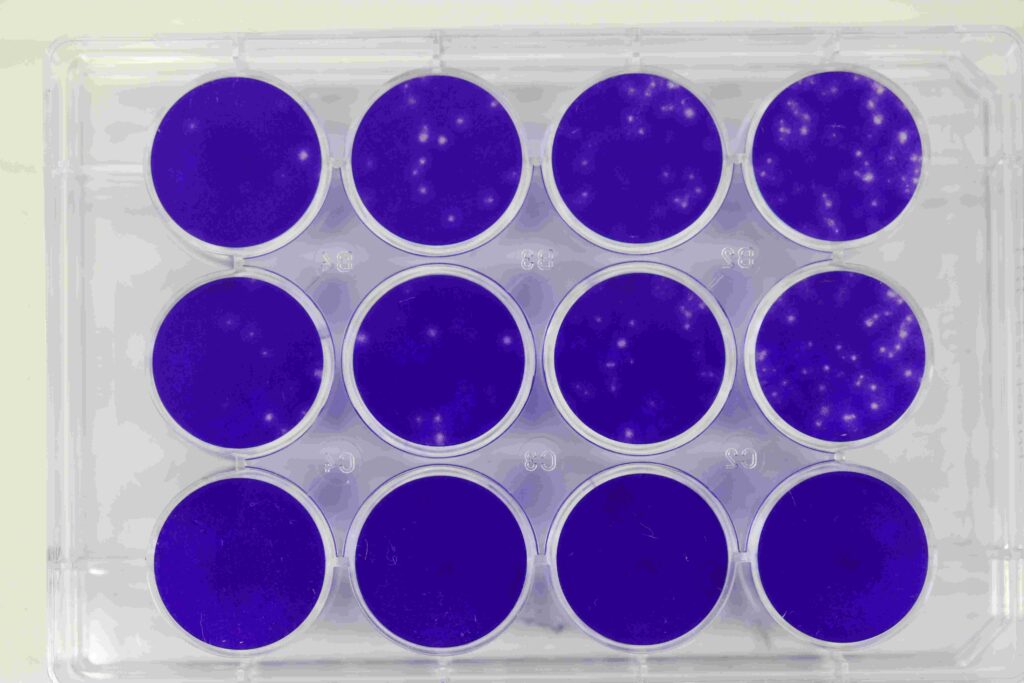 Nahaufnahme einer transparenten Laborplatte mit zwölf runden Vertiefungen. Die Vertiefungen sind mit einer violett gefärbten Zellschicht bedeckt. In mehreren Feldern sind unterschiedlich viele helle, punktförmige Bereiche sichtbar, die bei einem Plaque-Assay auf durch Viren geschädigte Zellbereiche hinweisen.